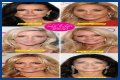 Botox, Implants & More! – Hollywood Life